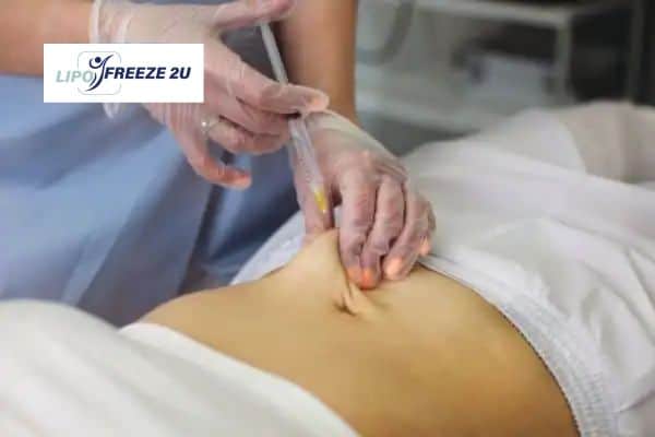 Fat Dissolving Injections Newark-on-Trent & Weight loss medication