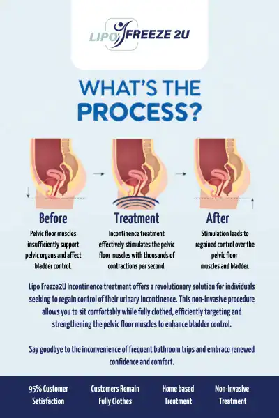 Diagram of how incontinence treatment Newark-on-Trent works.
