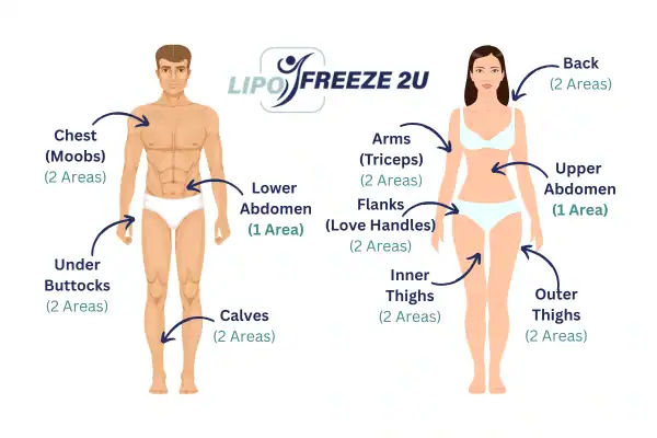 Areas you can have fat freezing treatment Newark-on-Trent