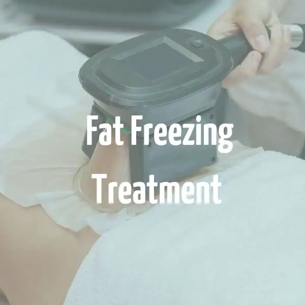 fat freezing treatment Newark-on-Trent