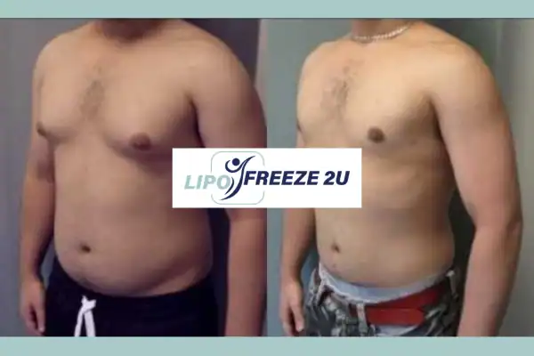 How Long Does It Take to See Results Newark-on-Trent?