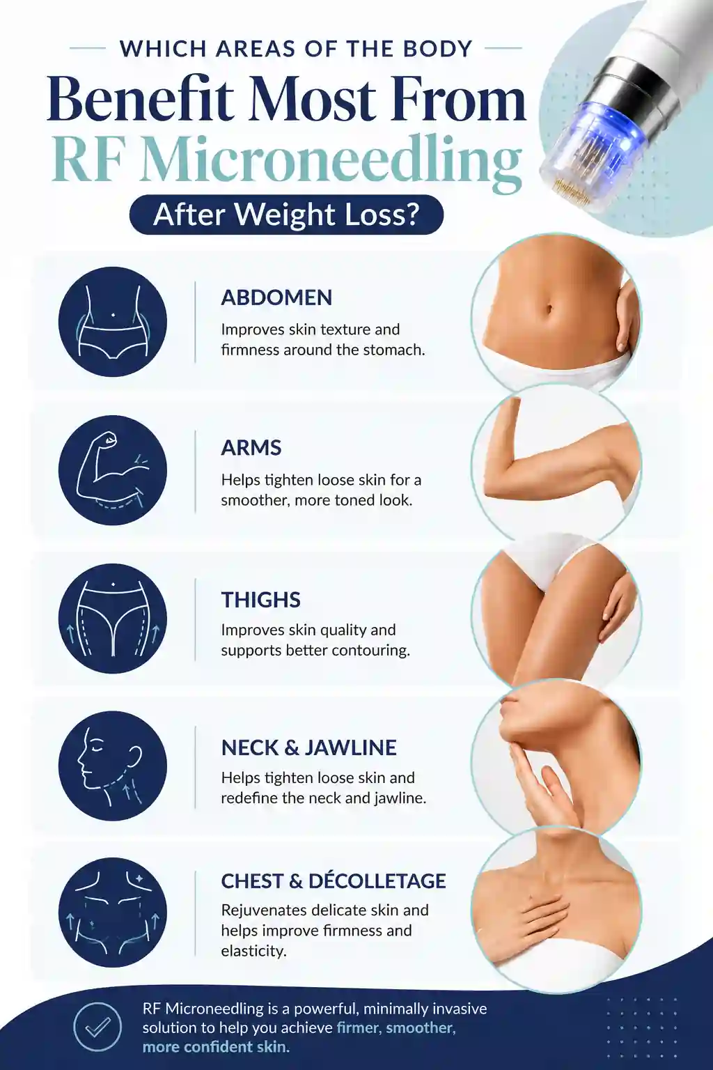 Which Areas of the Body Benefit Most From RF Microneedling After Weight Loss Newark-on-Trent